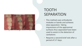 Methods of Caries Detection[1].pptx by jerry | PPTX
