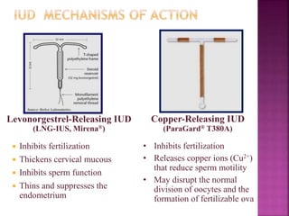 Levonorgestrel-Releasing IUD
(LNG-IUS, Mirena®)
 Inhibits fertilization
 Thickens cervical mucous
 Inhibits sperm function
 Thins and suppresses the
endometrium
Copper-Releasing IUD
(ParaGard® T380A)
• Inhibits fertilization
• Releases copper ions (Cu2+)
that reduce sperm motility
• May disrupt the normal
division of oocytes and the
formation of fertilizable ova
 