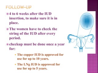  4 to 6 weeks after the IUD
insertion, to make sure it is in
place.
 The women have to check the
string of the IUD after every
period.
 checkup must be done once a year
for:
 The copper IUD is approved for
use for up to 10 years.
 The LNg IUD is approved for
use for up to 5 years.
 