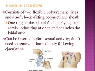 Consists of two flexible polyurethane rings
and a soft, loose-fitting polyurethane sheath
 One ring at closed end fits loosely against
cervix; other ring at open end encircles the
labial area
Can be inserted before sexual activity; don’t
need to remove it immediately following
ejaculation
 