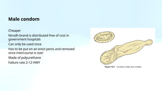 Nirodh Using Methods of contraception OBG GYN 2nd year.pptx