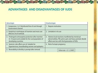 ADVANTAGES AND DISADVANTAGES OF IUDS
 