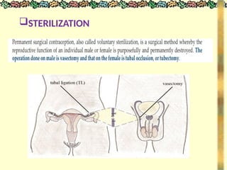 STERILIZATION
 