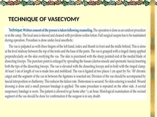 TECHNIQUE OF VASECYOMY
 