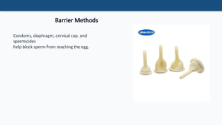 Barrier Methods Types Comprehensive Guide to Methods of Contraception and Their Effectiveness ...