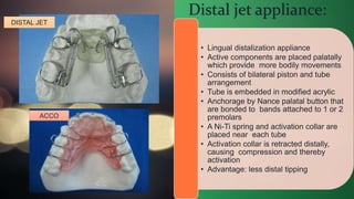 Distalisation Jet METHODS OF GAINIG SPACES DIVYA SINGH.pptx
