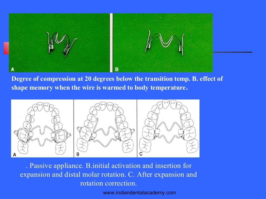 Methods of gaining space. /certified fixed orthodontic courses by Ind…