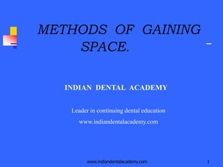 www.indiandentalacademy.com 1
METHODS OF GAINING
SPACE.
INDIAN DENTAL ACADEMY
Leader in continuing dental education
www.indiandentalacademy.com
 