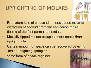  Premature loss of a second deciduous molar or
extraction of second premolar can cause mesial
tipping of the first permanent molar.
 Mesially tipped molars occupied more space than
upright molar.
 Certain amount of space can be recovered by using
molar uprighting spring or
some form of space regainer.
 