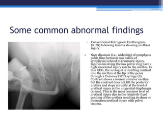 Methods of imaging of the urinary tract using contrast | PPTX