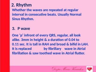 Comprehensive Overview of Electrocardiogram (ECG) Interpretation and ...