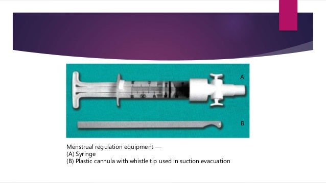 Methods of termination of pregnancy