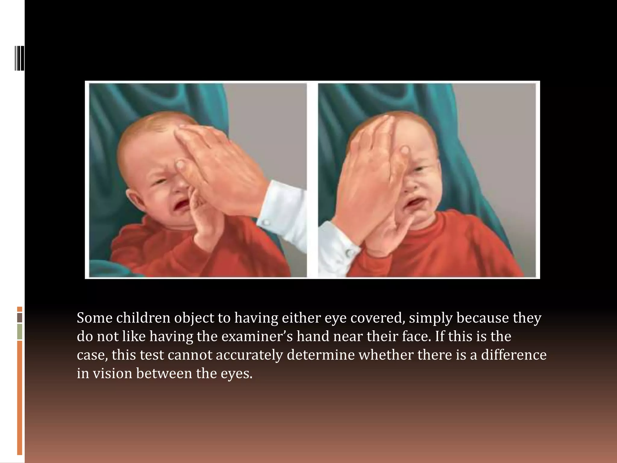 Some children object to having either eye covered, simply because they
do not like having the examiner’s hand near their face. If this is the
case, this test cannot accurately determine whether there is a difference
in vision between the eyes.
 