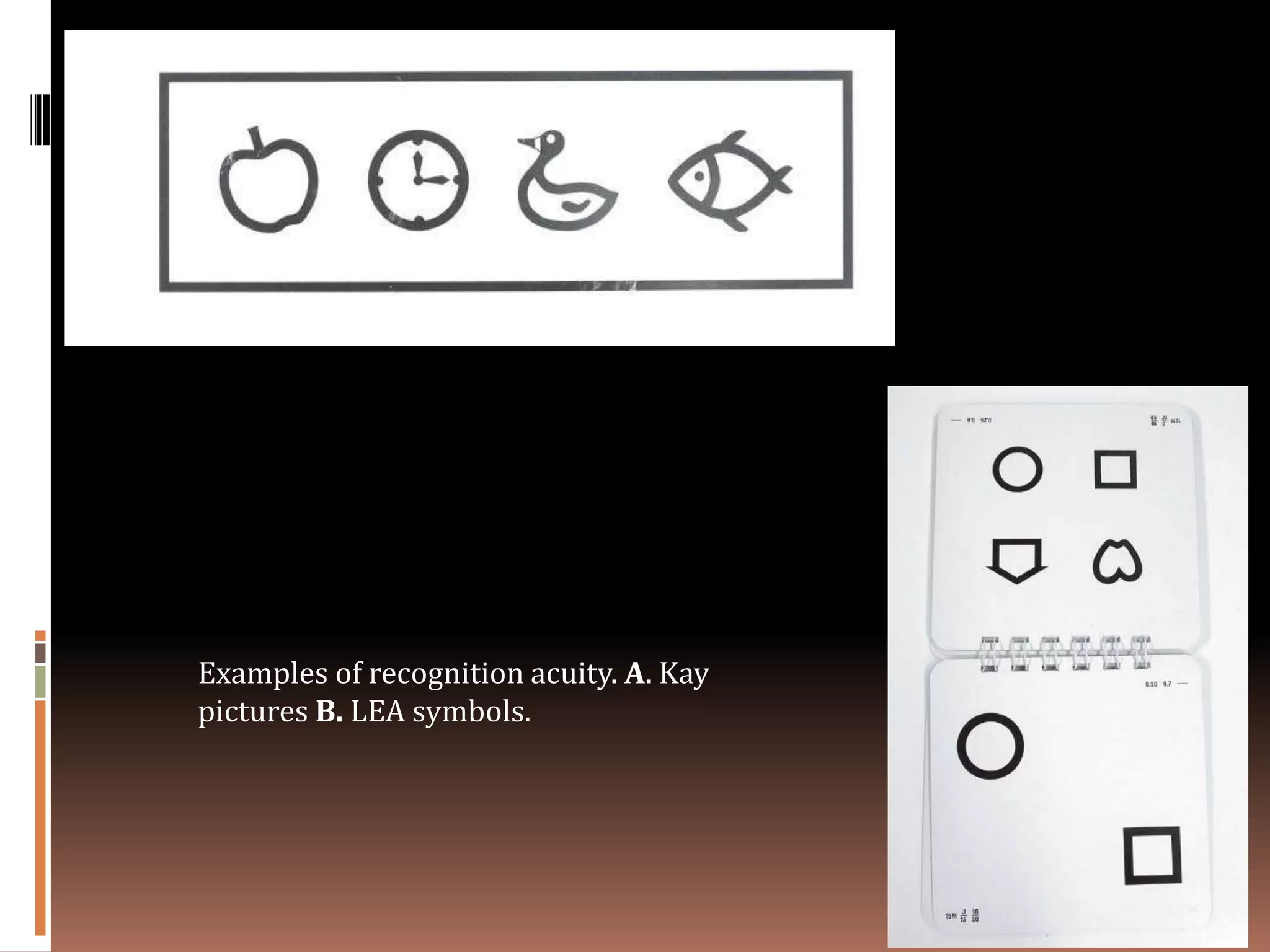 Examples of recognition acuity. A. Kay
pictures B. LEA symbols.
 
