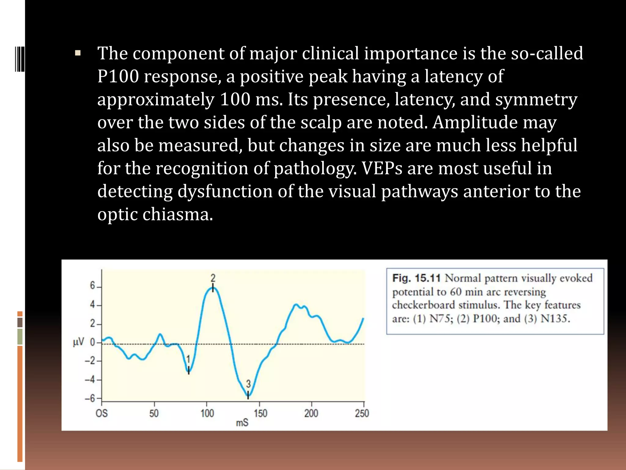  The component of major clinical importance is the so-called
  P100 response, a positive peak having a latency of
  approximately 100 ms. Its presence, latency, and symmetry
  over the two sides of the scalp are noted. Amplitude may
  also be measured, but changes in size are much less helpful
  for the recognition of pathology. VEPs are most useful in
  detecting dysfunction of the visual pathways anterior to the
  optic chiasma.
 