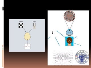 Methods of visual acuity testing in preverbal children | PPTX
