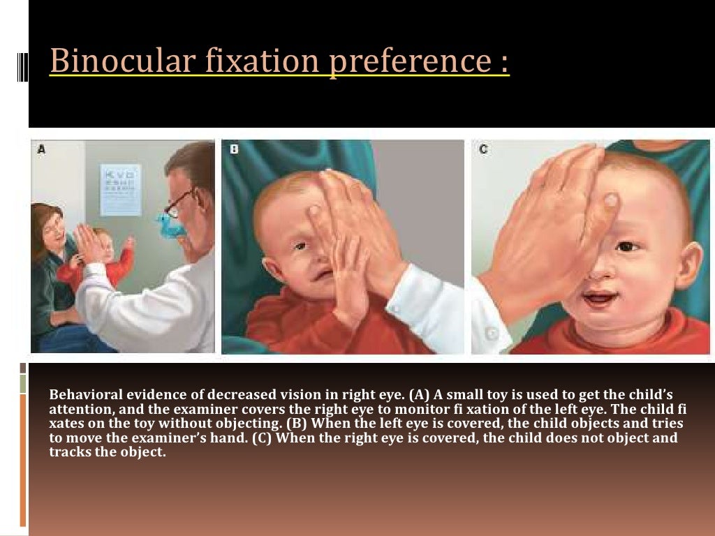 Methods of visual acuity testing in preverbal children