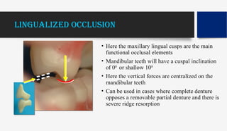 Cuspal Ridges methodstoimprovecomletedenturefoundation2-160314192257.pptx