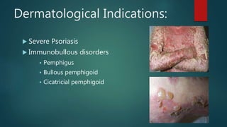 Dermatological Indications:
 Severe Psoriasis
 Immunobullous disorders
 Pemphigus
 Bullous pemphigoid
 Cicatricial pemphigoid
 