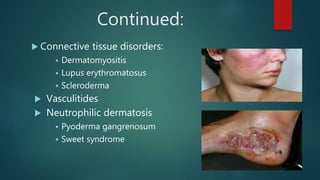Continued:
 Connective tissue disorders:
 Dermatomyositis
 Lupus erythromatosus
 Scleroderma
 Vasculitides
 Neutrophilic dermatosis
 Pyoderma gangrenosum
 Sweet syndrome
 