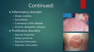 Continued:
 Inflammatory disorders
 Atopic eczema
 Sarcoidosis
 Cutaneous crohn disease
 Chronic idiopathic urticaria
 Proliferative disorders
 Mycosis fungoides
 Sezary syndrome
 Pityriasis lichenoides
 Petyriasis rubra pilaris
 