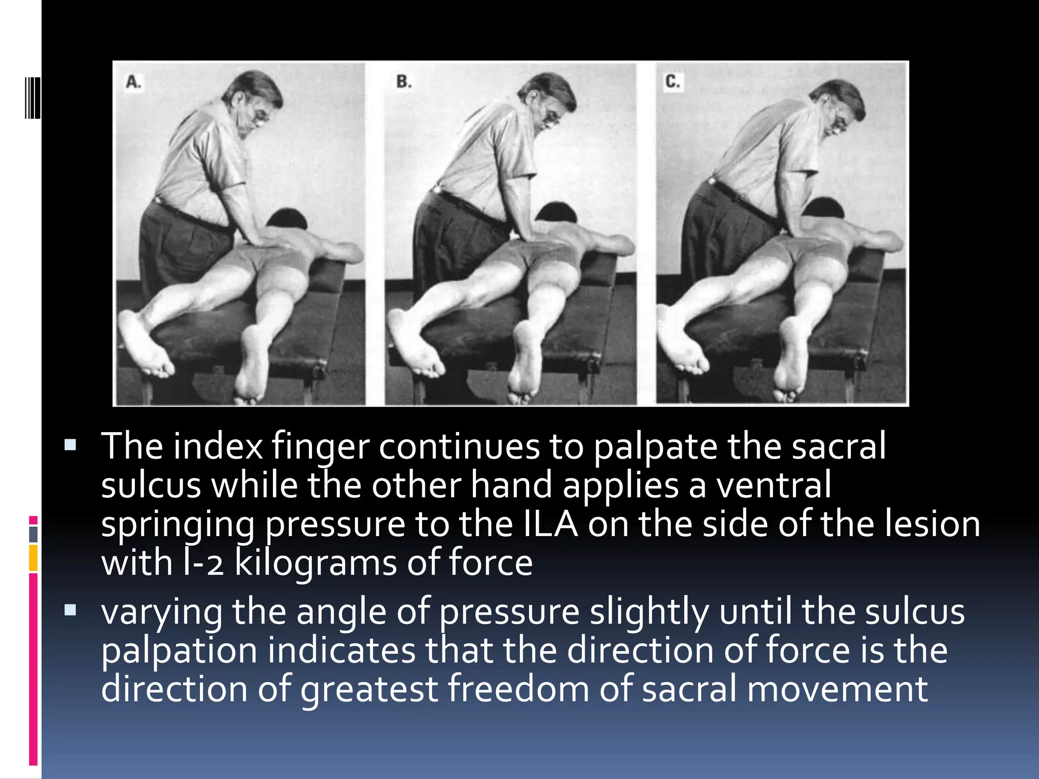  The index finger continues to palpate the sacral
sulcus while the other hand applies a ventral
springing pressure to the ILA on the side of the lesion
with l-2 kilograms of force
 varying the angle of pressure slightly until the sulcus
palpation indicates that the direction of force is the
direction of greatest freedom of sacral movement
 