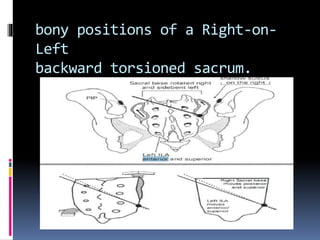 Met in si joint dysfunction | PPTX