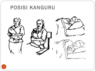 POSISI KANGURU 