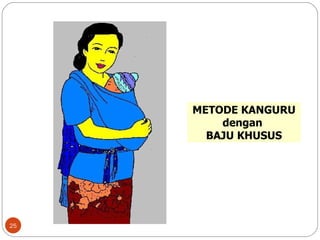METODE KANGURU dengan  BAJU KHUSUS 