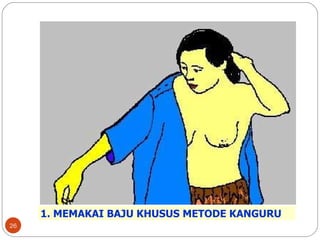 1. MEMAKAI BAJU KHUSUS METODE KANGURU 