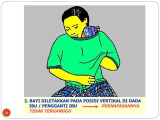 2. BAYI DILETAKKAN PADA POSISI VERTIKAL DI DADA  IBU / PENGGANTI IBU  PERNAFASANNYA  TIDAK TERGANGGU 