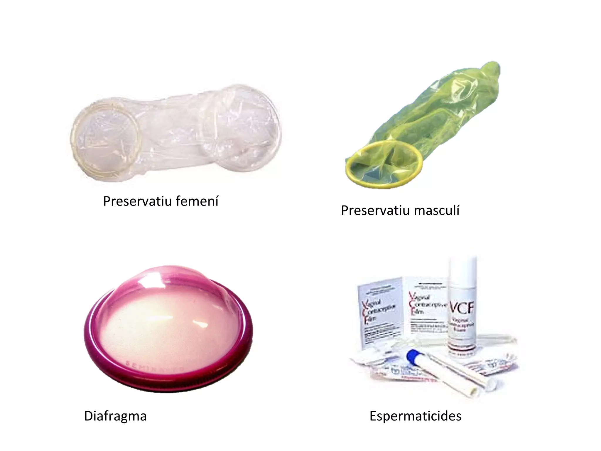 Preservatiu femení
Preservatiu masculí
Diafragma Espermaticides
 