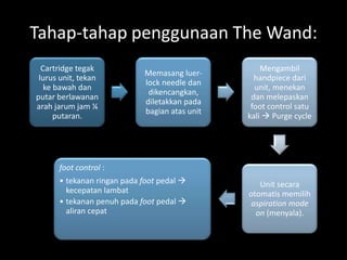 Tahap-tahap penggunaan The Wand:
Cartridge tegak
lurus unit, tekan
ke bawah dan
putar berlawanan
arah jarum jam ¼
putaran.

Memasang luerlock needle dan
dikencangkan,
diletakkan pada
bagian atas unit

Mengambil
handpiece dari
unit, menekan
dan melepaskan
foot control satu
kali  Purge cycle

foot control :
• tekanan ringan pada foot pedal 
kecepatan lambat
• tekanan penuh pada foot pedal 
aliran cepat

Unit secara
otomatis memilih
aspiration mode
on (menyala).

 