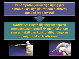 Penempatan jarum dgn ujung jari
dimanipulasi dgn akurat dan diaktivasi
melalui foot control

Handpiece ringan digenggam seperti
menggenggam pensil  meningkatkan
sensasi taktil dan kontrol dibandingkan
penyuntikkan tradisional

 