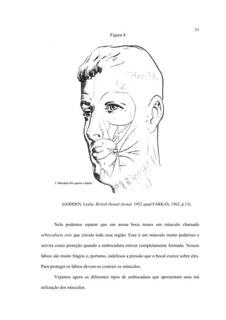 11
Figura 4
(GODDEN, Leslie. British Dental Jornal. 1952 apud FARKAS, 1962, p.13).
Nela podemos reparar que em nossa boca temos um músculo chamado
orbircularis oris que circula toda essa região. Esse é um músculo muito poderoso e
servira como proteção quando a embocadura estiver completamente formada. Nossos
lábios são muito frágeis e, portanto, indefesos a pressão que o bocal exerce sobre eles.
Para proteger os lábios devem-se contrair os músculos.
Vejamos agora os diferentes tipos de embocadura que apresentam uma má
utilização dos músculos.
 