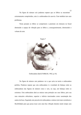13
Na figura de número seis podemos reparar que os lábios se encontram
extremamente comprimidos, esta é a embocadura do assovio. Esta também tem seus
problemas.
Nesta posição os lábios se comprimem e penetram em demasia no bocal
diminuído o espaço de vibração para os lábios e, consequentemente, diminuindo o
volume de som.
Figura 7
Embocadura ideal (FARKAS, 1962, p.14).
Na figura de número sete podemos ver o que seria na teoria a embocadura
perfeita. Podemos reparar que esta embocadura é o resultado do balanço entre as
embocaduras das figuras de número cinco e seis, ou seja, um balanço entre os
extremos. Esta embocadura dará ao músico uma proteção aos seus lábios, pois usa
seus músculos orbiculares, superior e inferior tencionados como sustentação dos
cantos da boca. Seguindo este preceito de embocadura o músico terá mais resistência e
flexibilidade para que possa tocar com uma boa vibração durante muito tempo sem
 