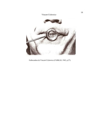 18
Vincent Cichowicz
Embocadura de Vincent Cichowicz (FARKAS, 1962, p.27).
 