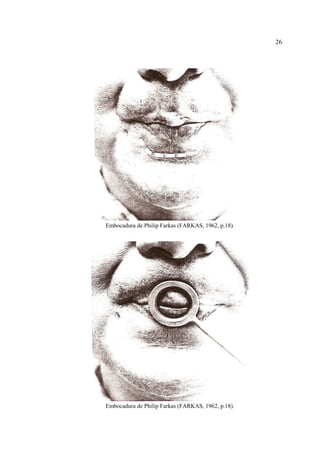 26
Embocadura de Philip Farkas (FARKAS, 1962, p.18).
Embocadura de Philip Farkas (FARKAS, 1962, p.18).
 