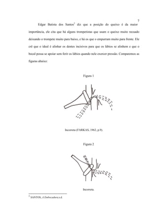 7
Edgar Batista dos Santos2
diz que a posição do queixo é da maior
importância, ele cita que há alguns trompetistas que usam o queixo muito recuado
deixando o trompete muito para baixo, e há os que o empurram muito para frente. Ele
crê que o ideal é alinhar os dentes incisivos para que os lábios se alinhem e que o
bocal possa se apoiar sem ferir os lábios quando nele exercer pressão. Comparemos as
figuras abaixo:
Figura 1
Incorreta (FARKAS, 1962, p.9).
Figura 2
Incorreta.
2
SANTOS, A Embocadura,s.d.
 