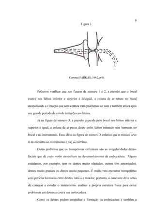 8
Figura 3
Correta (FARKAS, 1962, p.9).
Podemos verificar que nas figuras de número 1 e 2, a pressão que o bocal
exerce nos lábios inferior e superior é desigual, a coluna de ar rebate no bocal
atrapalhando a vibração que com certeza trará problemas ao som e também criara após
um grande período de estudo irritações aos lábios.
Já na figura de número 3, a pressão exercida pelo bocal nos lábios inferior e
superior é igual, a coluna de ar passa direto pelos lábios entrando sem barreiras no
bocal e no instrumento. Essa idéia da figura de número 3 enfatiza que o músico deve
ir de encontro ao instrumento e não o contrário.
Outro problema que os trompetistas enfrentam são as irregularidades dento-
faciais que de certo modo atrapalham no desenvolvimento da embocadura. Alguns
estudantes, por exemplo, tem os dentes muito afastados, outros têm amontoados,
dentes muito grandes ou dentes muito pequenos. É muito raro encontrar trompetistas
com perfeita harmonia entre dentes, lábios e maxilar, portanto, o estudante deve antes
de começar a estudar o instrumento, analisar a própria estrutura física para evitar
problemas em demasia com a sua embocadura.
Como os dentes podem atrapalhar a formação da embocadura e também o
 