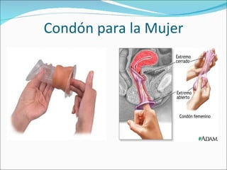 Condón para la Mujer 