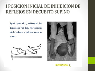 I POSICION INICIAL DE INHIBICION DE
REFLEJOS EN DECUBITO SUPINO
 