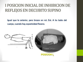 I POSICION INICIAL DE INHIBICION DE
REFLEJOS EN DECUBITO SUPINO
 