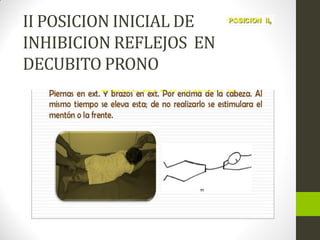 II POSICION INICIAL DE
INHIBICION REFLEJOS EN
DECUBITO PRONO
 