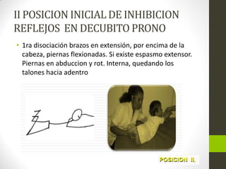 II POSICION INICIAL DE INHIBICION
REFLEJOS EN DECUBITO PRONO
• 1ra disociación brazos en extensión, por encima de la
cabeza, piernas flexionadas. Si existe espasmo extensor.
Piernas en abduccion y rot. Interna, quedando los
talones hacia adentro
 