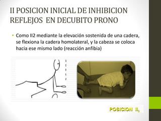 II POSICION INICIAL DE INHIBICION
REFLEJOS EN DECUBITO PRONO
• Como II2 mediante la elevación sostenida de una cadera,
se flexiona la cadera homolateral, y la cabeza se coloca
hacia ese mismo lado (reacción anfibia)
 
