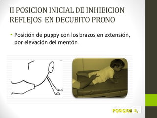 II POSICION INICIAL DE INHIBICION
REFLEJOS EN DECUBITO PRONO
• Posición de puppy con los brazos en extensión,
por elevación del mentón.
 
