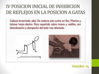 IV POSICION INICIAL DE INHIBICION
DE REFLEJOS EN LA POSICION A GATAS
 