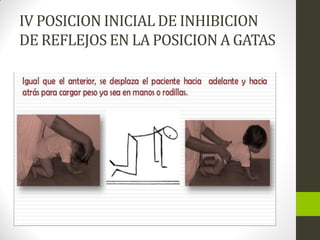 IV POSICION INICIAL DE INHIBICION
DE REFLEJOS EN LA POSICION A GATAS
 