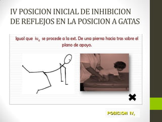 IV POSICION INICIAL DE INHIBICION
DE REFLEJOS EN LA POSICION A GATAS
 